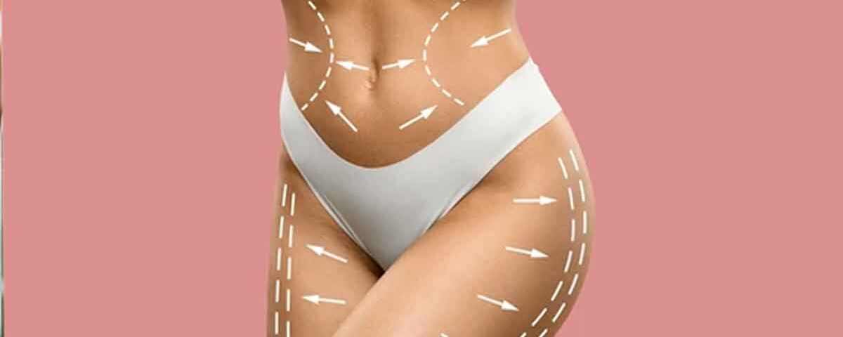 remodelare corporala non invaziva