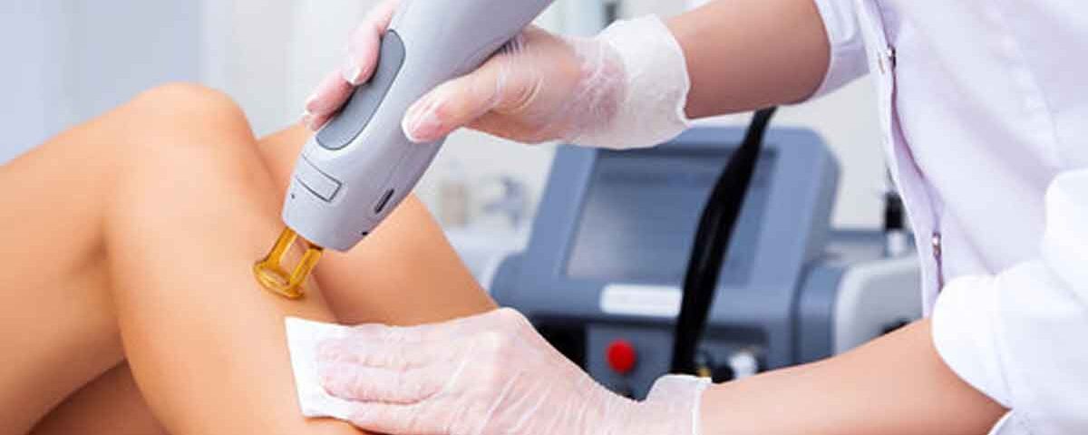 epilare definitiva toamna ghid